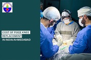 Looking for a Pixee Knee Replacement in Ahmedabad,  India